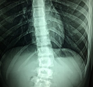 ABOGADO NEGLIGENCIAS MÉDICAS ALMERÍA