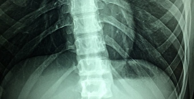 ABOGADO NEGLIGENCIAS MÉDICAS ALMERÍA
