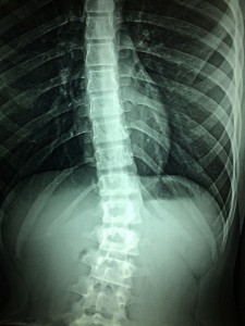 x-rays-1715903_960_720